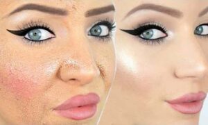 Why does my foundation look patchy and dry