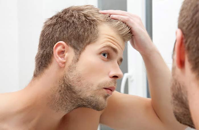 How to prevent hair loss in men? 
