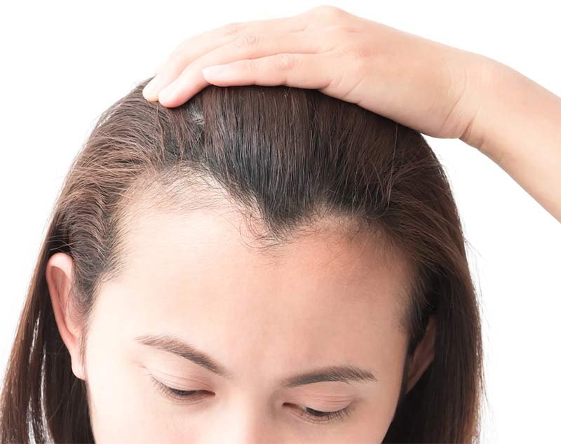 How to stop hair thinning?