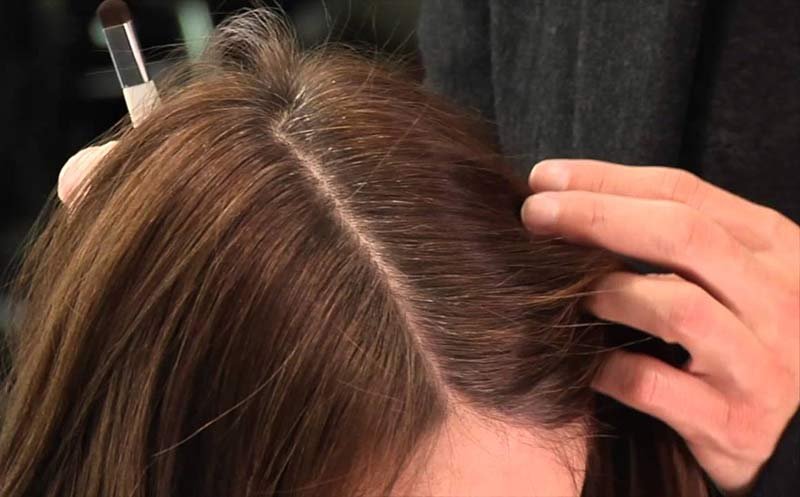 What causes FPHL (Female Pattern Hair Loss)?