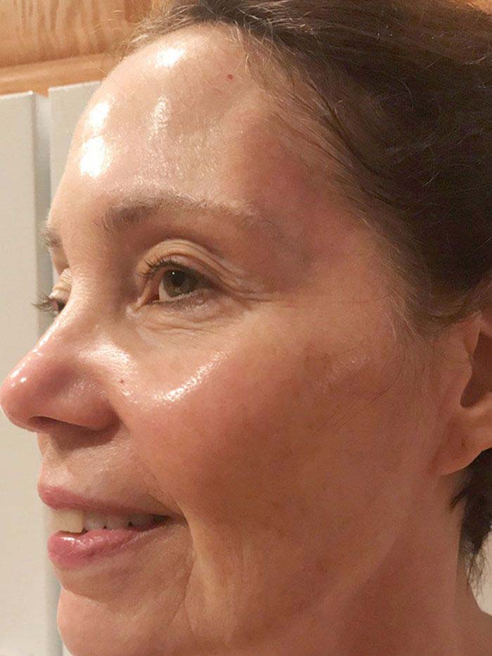 Best face serum for over 50