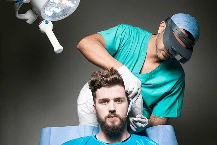 Look into facial hair transplants as a final option