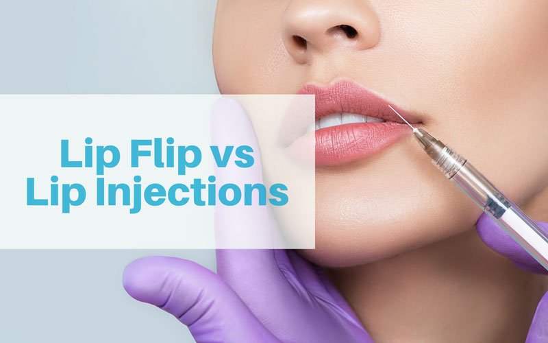 Lip fillers vs lip injections