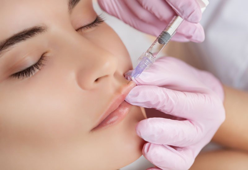 What does the Lip filler cost?